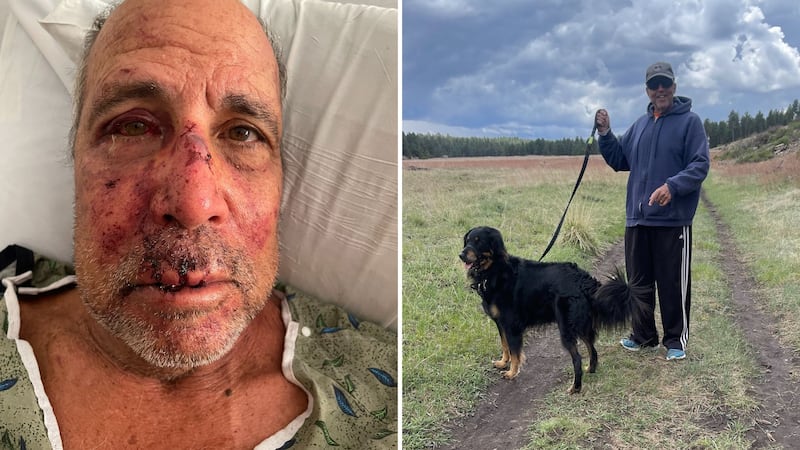 The attack happened as 71-year-old Jeff Zimmerman was walking the family dog in his...