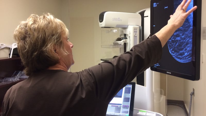 Latest in breast cancer detection technology available at Cabrini Hospital